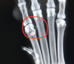 Poppy foot.png Poppy foot.png